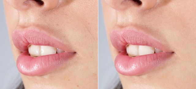 Arreglar imperfecciones con Photoshop